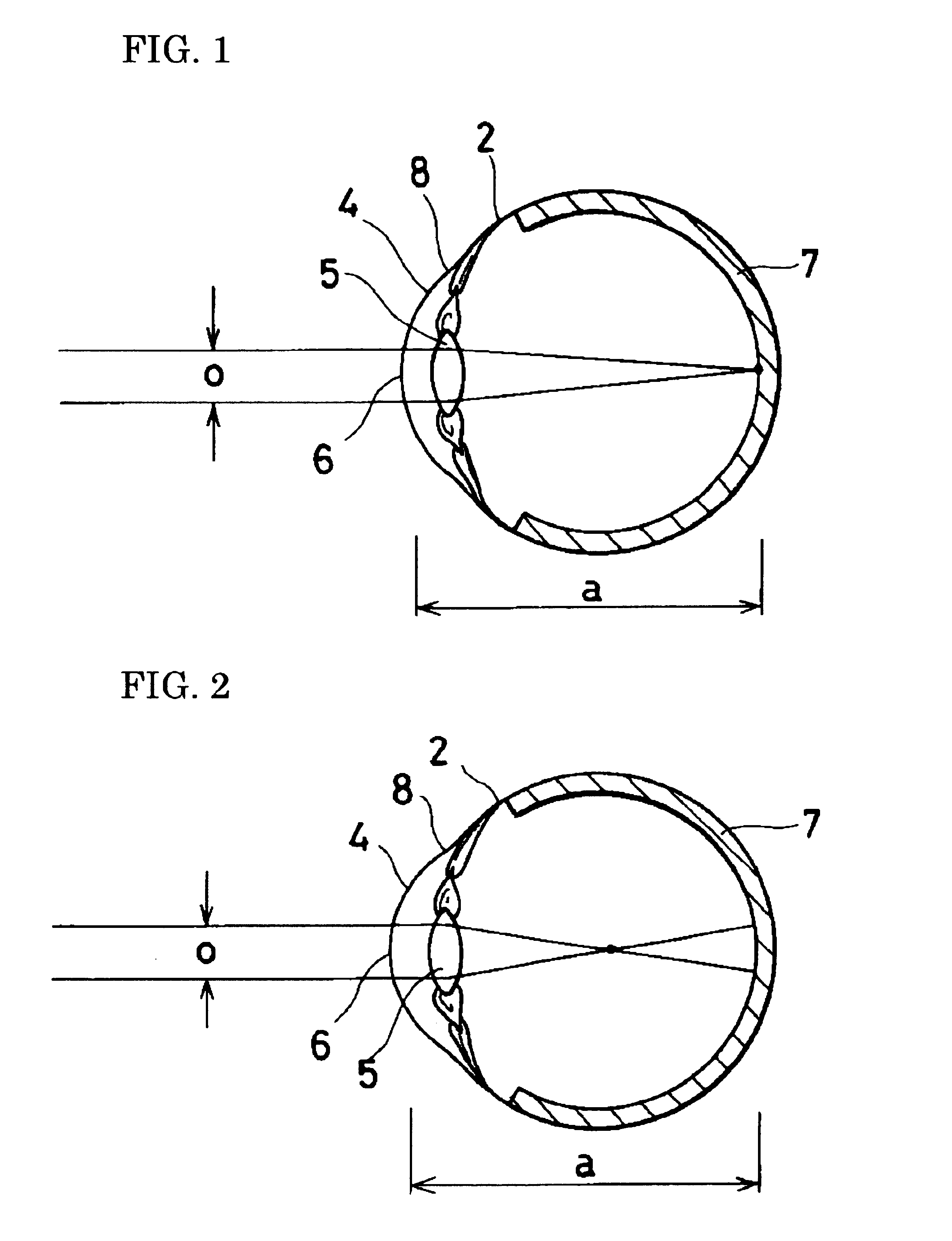 Contact lens for correcting myopia and/or astigmatism