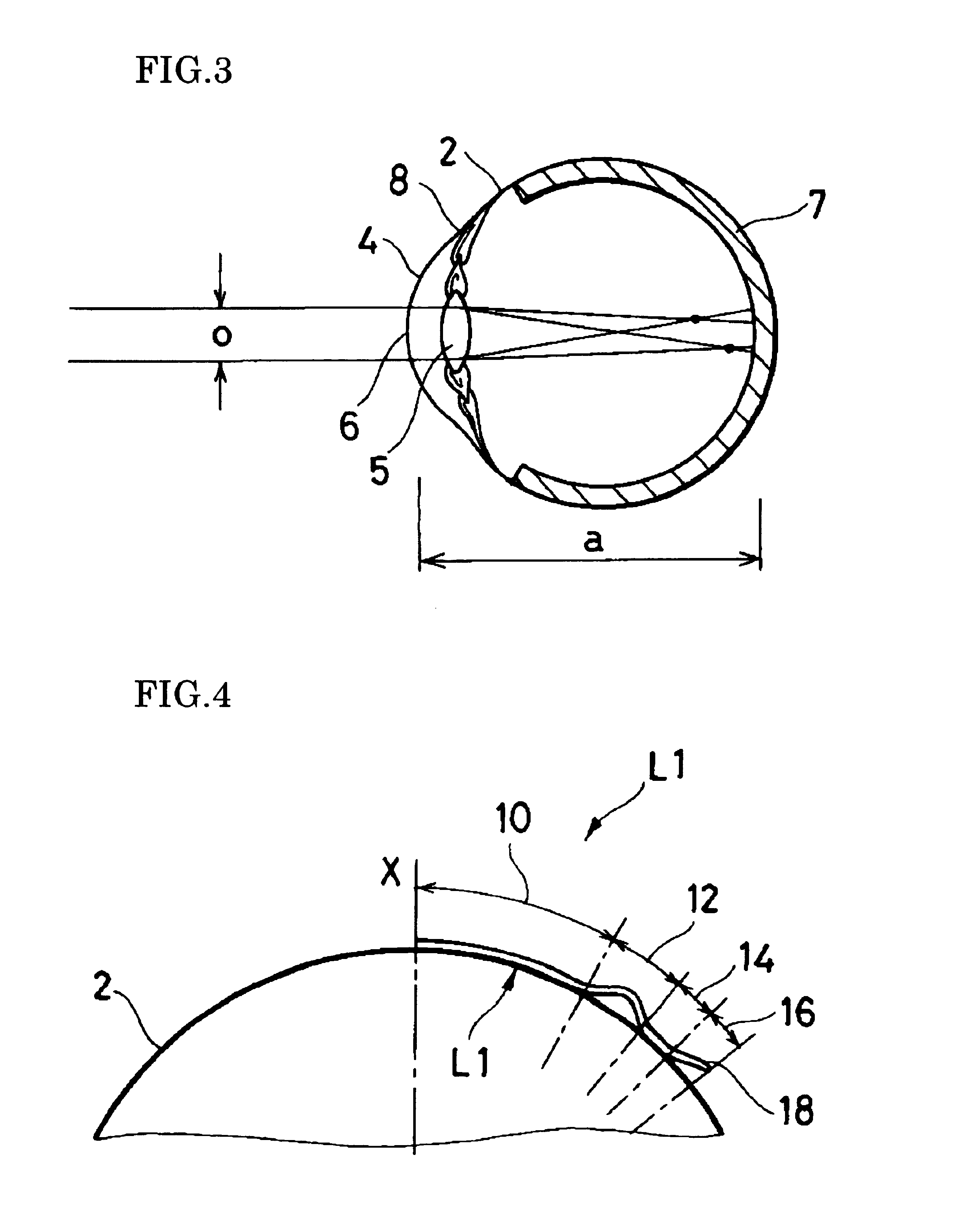 Contact lens for correcting myopia and/or astigmatism