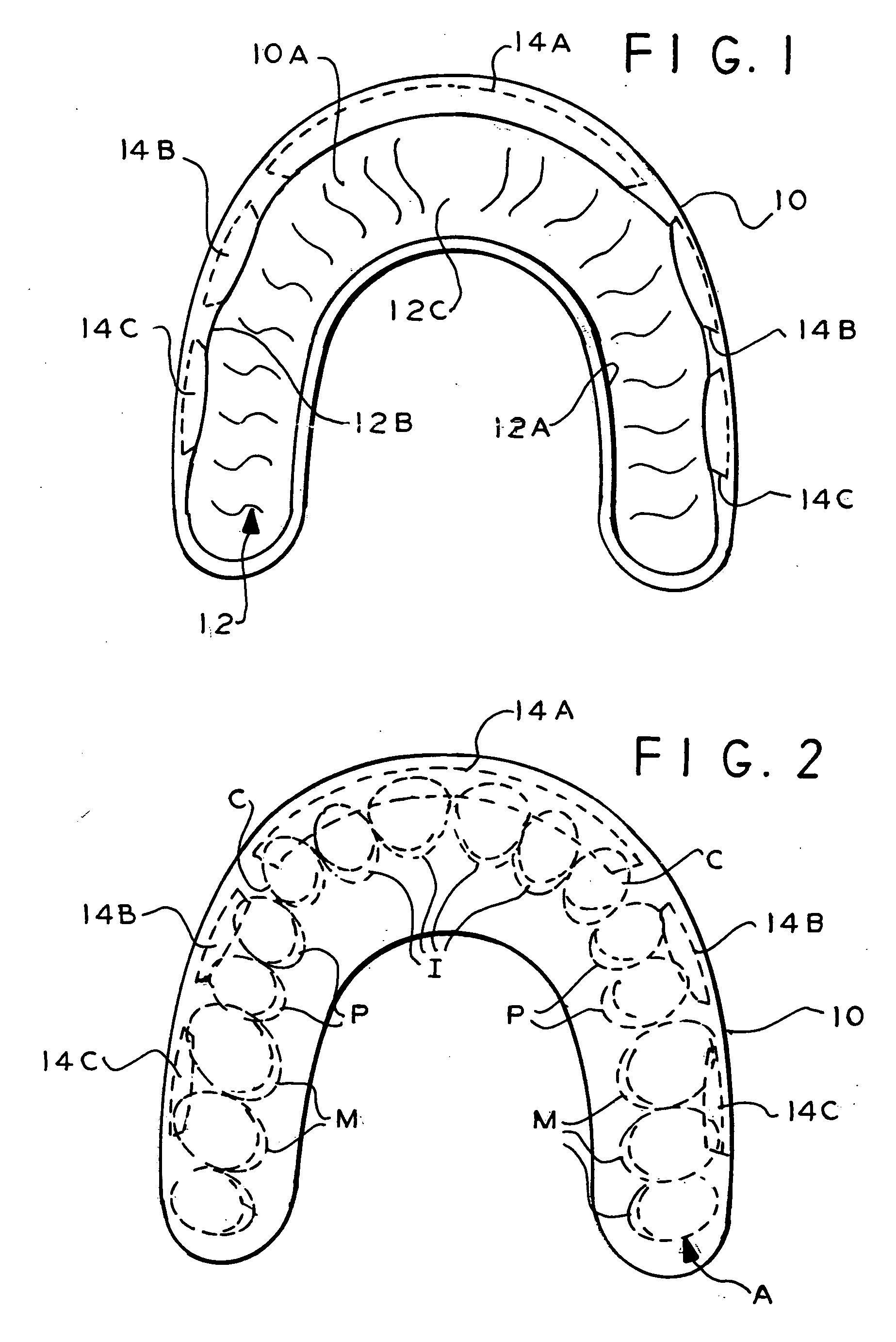 Therapeutic and protective dental device useful as an intra-oral delivery system