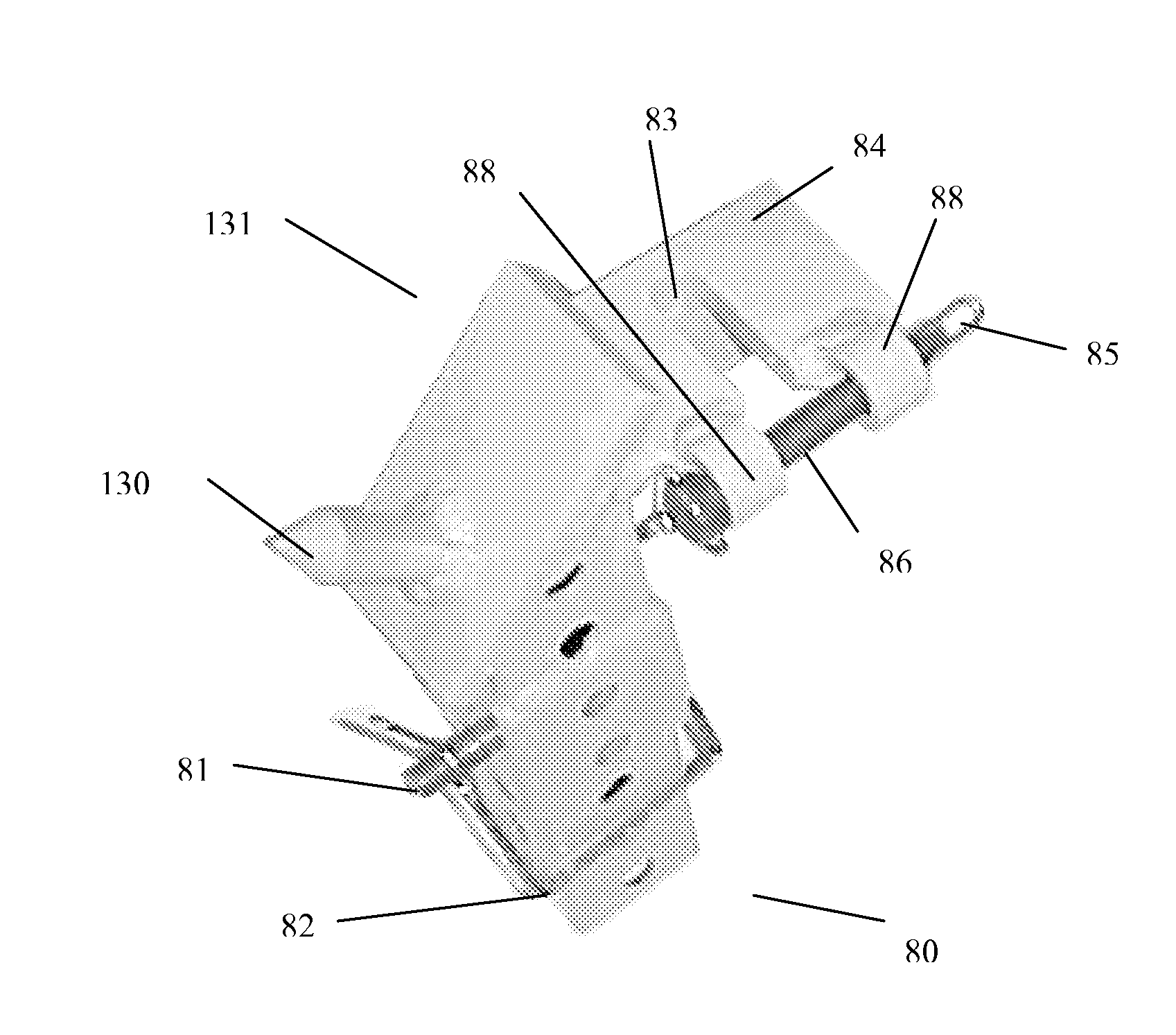 Method and apparatus for buttress stabilization
