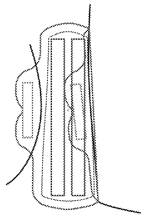 Disposable absorbent article having undergarment fastening elements