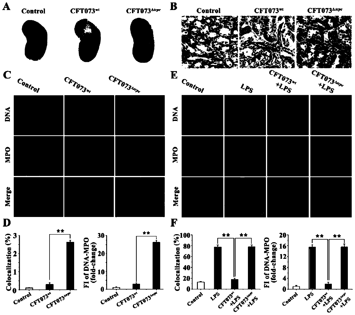 Novel NETosis inhibitor TcpC and application thereof