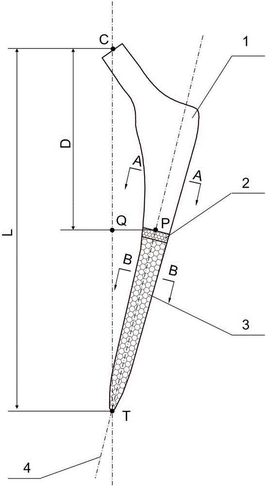 Self-adaptive later-period stable type femoral stem prosthesis