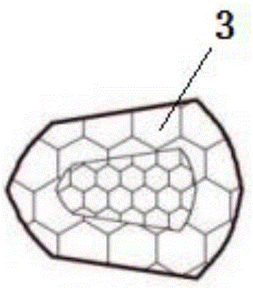 Self-adaptive later-period stable type femoral stem prosthesis