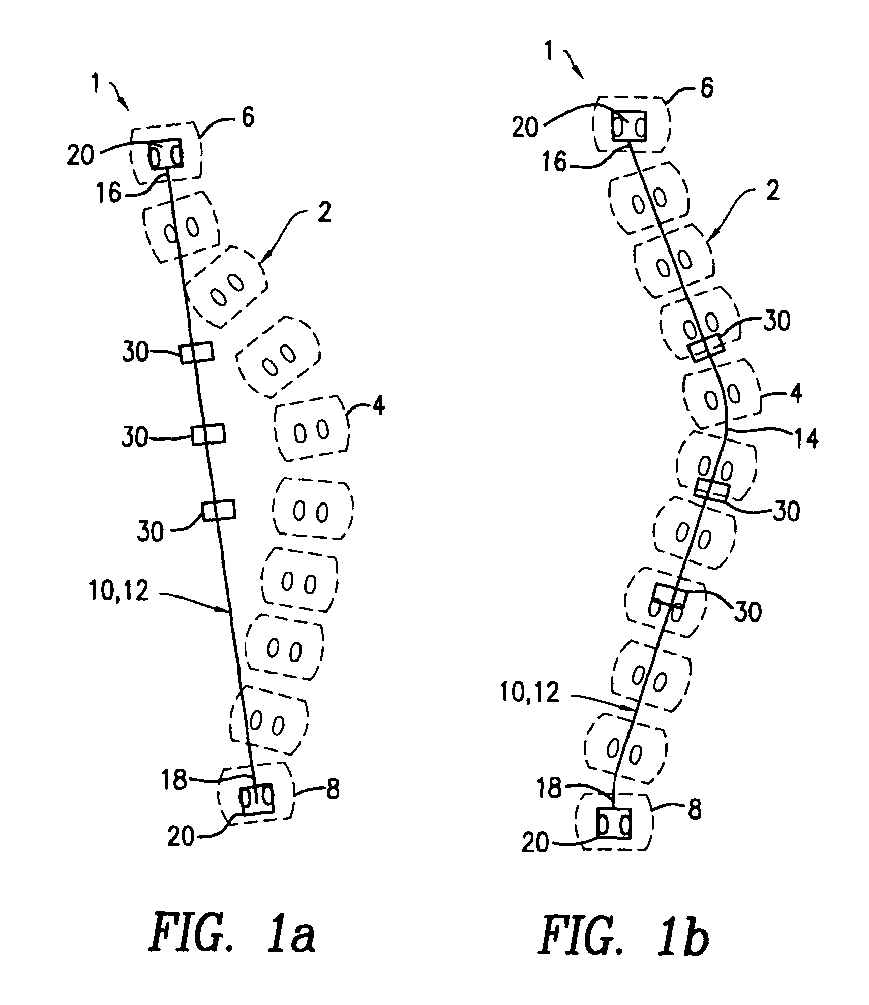 Device for correcting spinal deformities