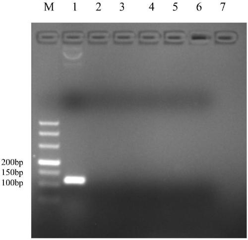 Primer set, reagent, kit and detection method for detecting and/or assisting detection of GI type norovirus