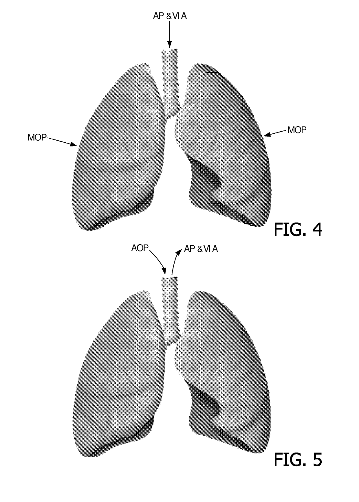 Device and method for assisting a cough
