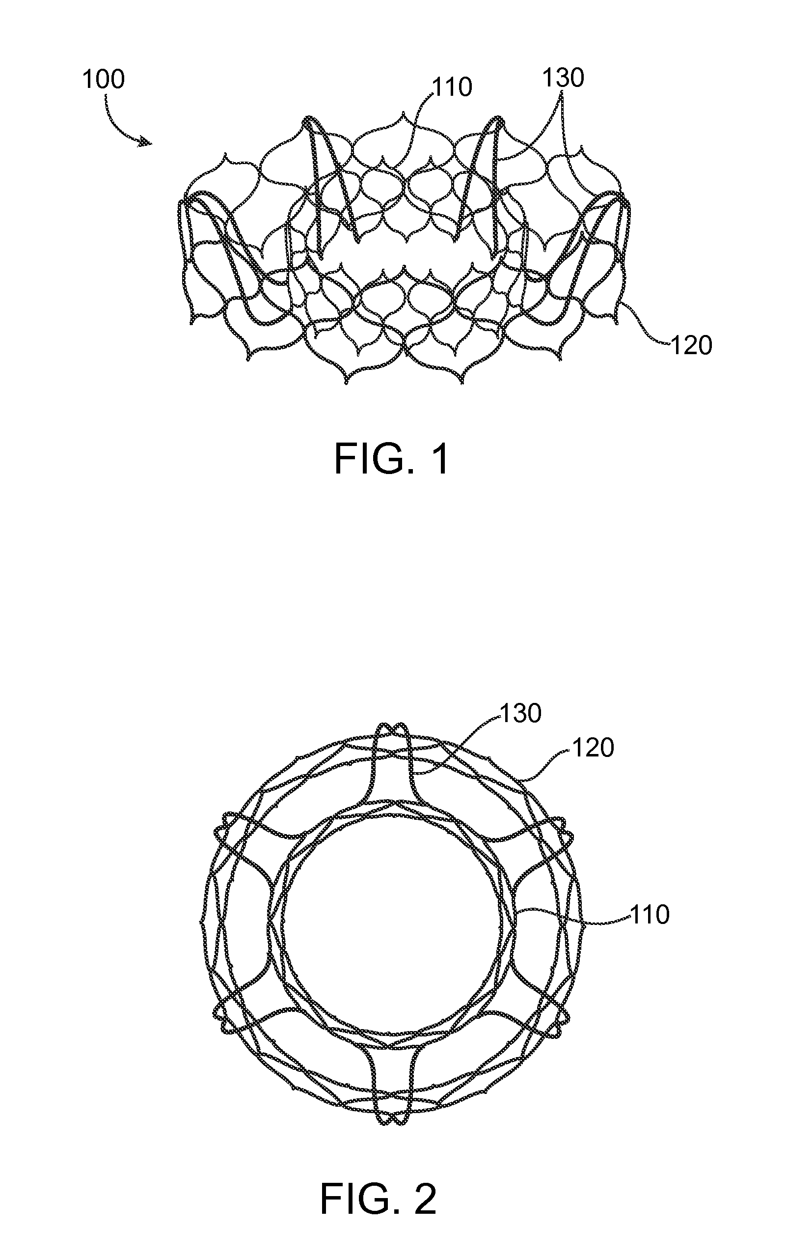 Valve Prosthesis and Method for Delivery