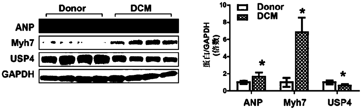 Function and application of ubiquitin-specific protease 4 (usp4) in the treatment of cardiac hypertrophy