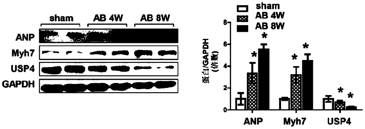 Function and application of ubiquitin-specific protease 4 (usp4) in the treatment of cardiac hypertrophy