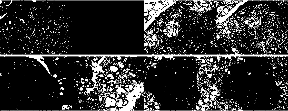 Soft fat fixing liquid and preparation method thereof