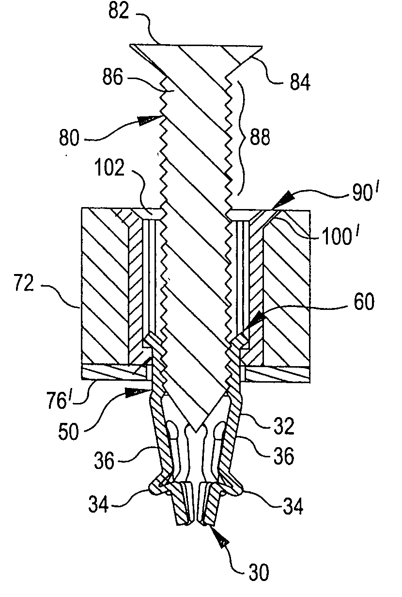 Expandable collet anchor system and method