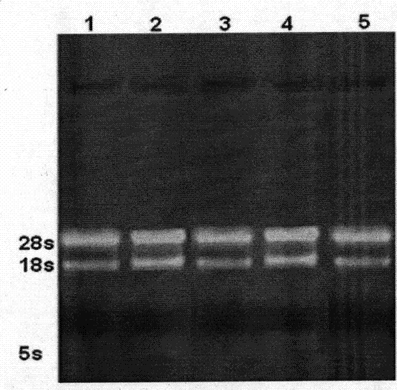 Method for detecting lily seed virus