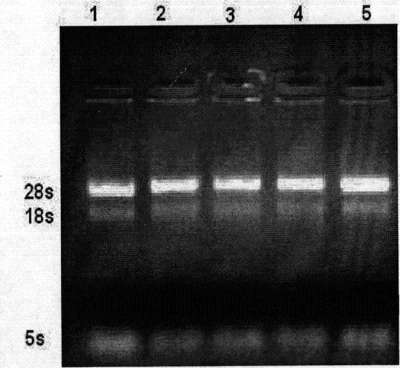 Method for detecting lily seed virus