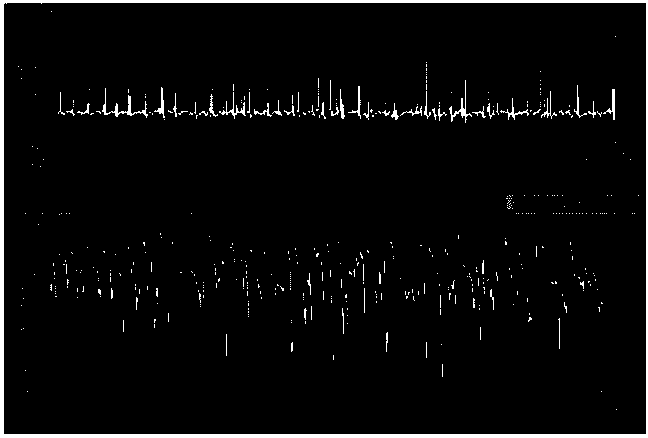 Underwater real-time micro-fluidic chip biochemical detection device and detection method thereof