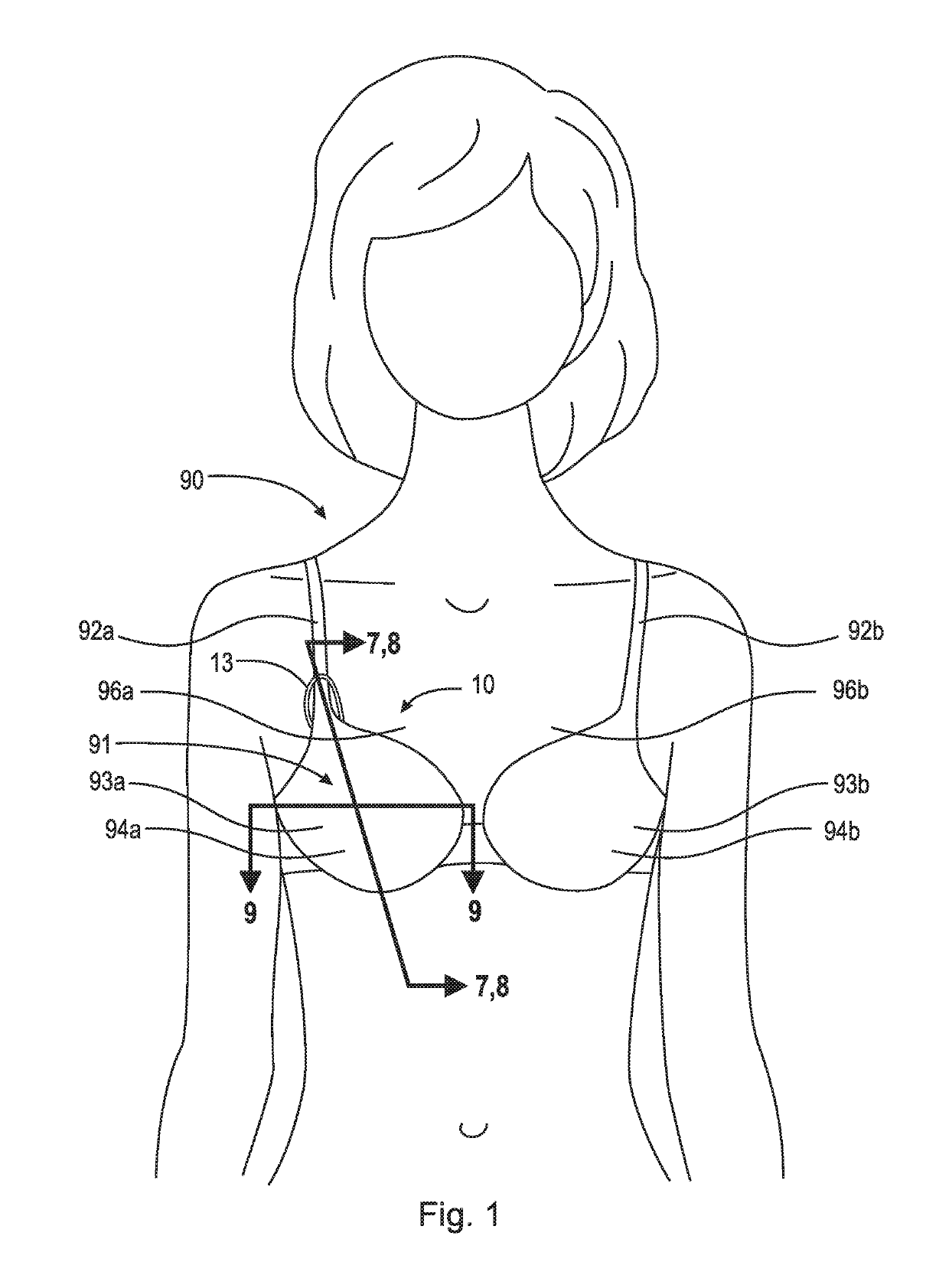 Thermal device for treating breastfeeding conditions