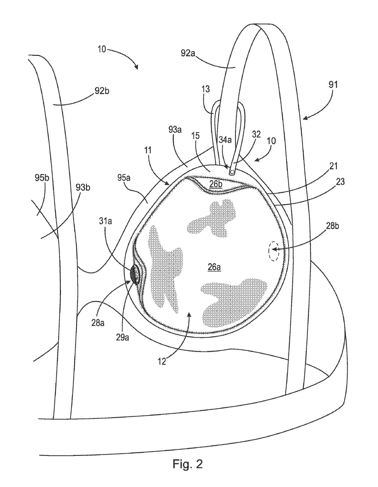 Thermal device for treating breastfeeding conditions