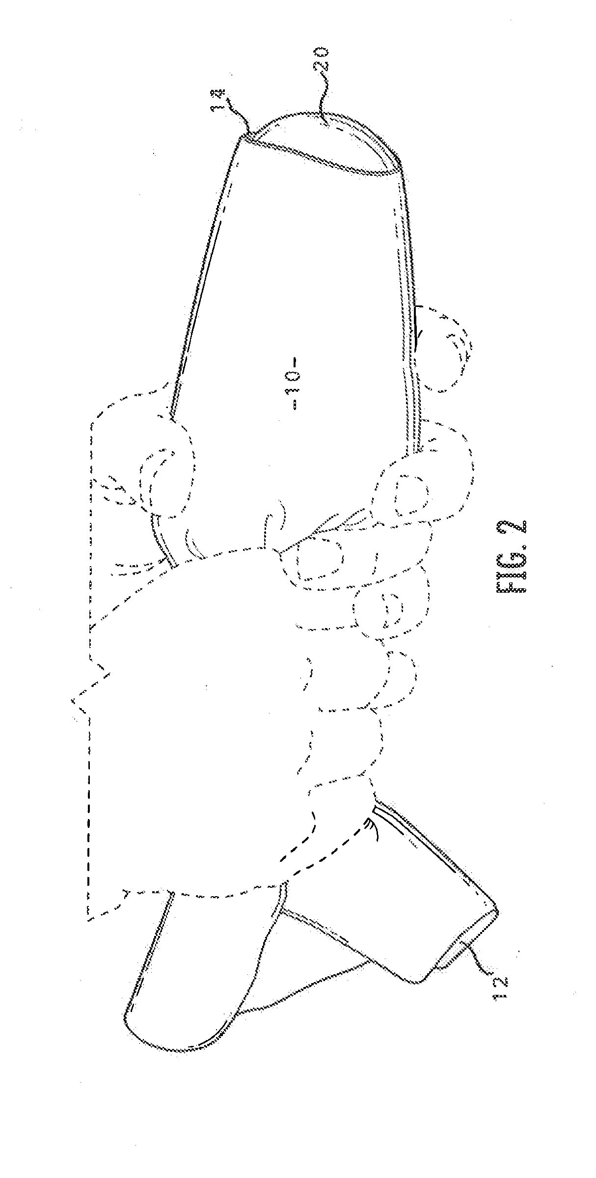 Apparatus and Process for Delivering a Silicone Prosthesis into a Surgical Pocket