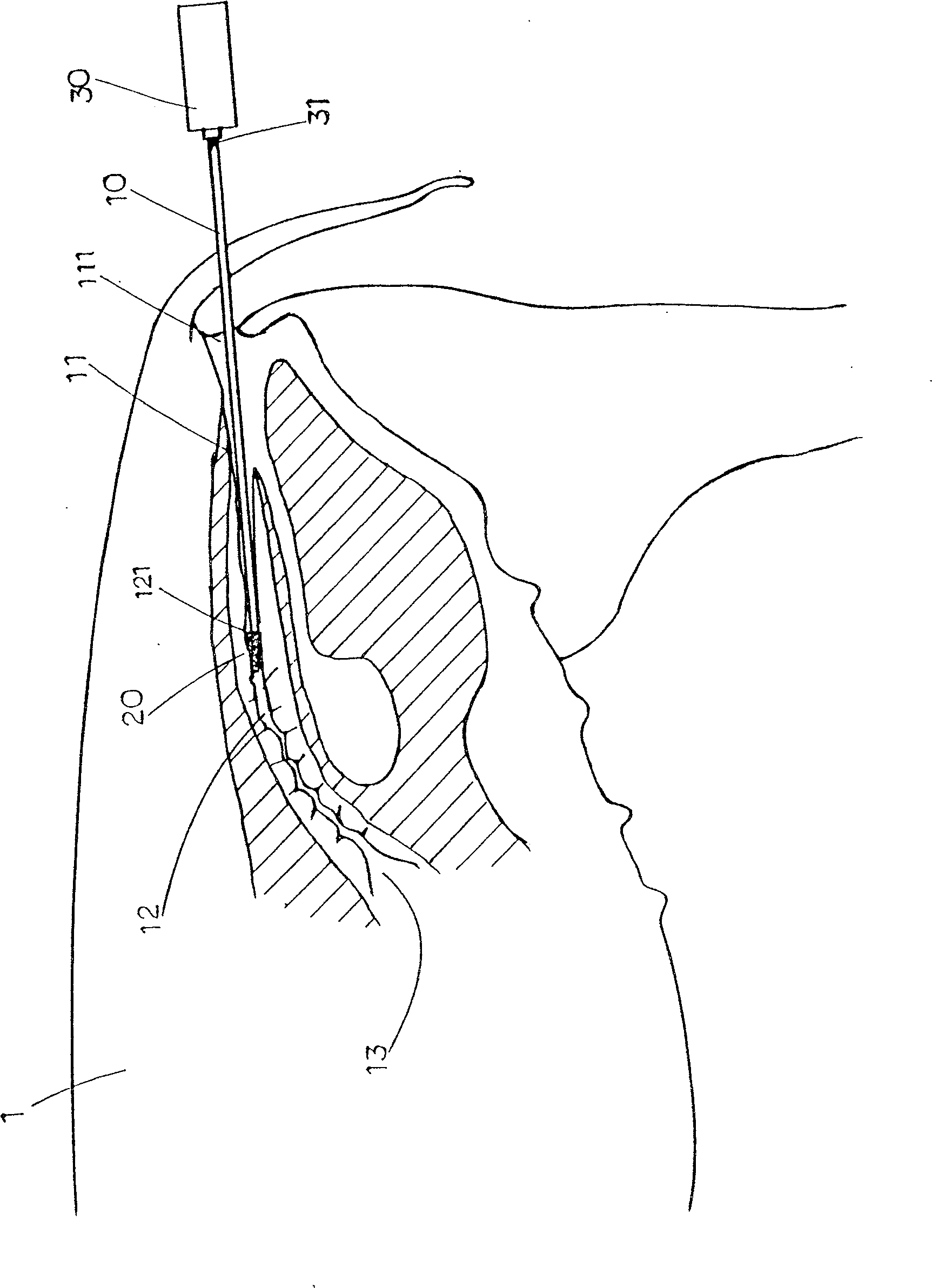 Artificial trace insemination device for animal