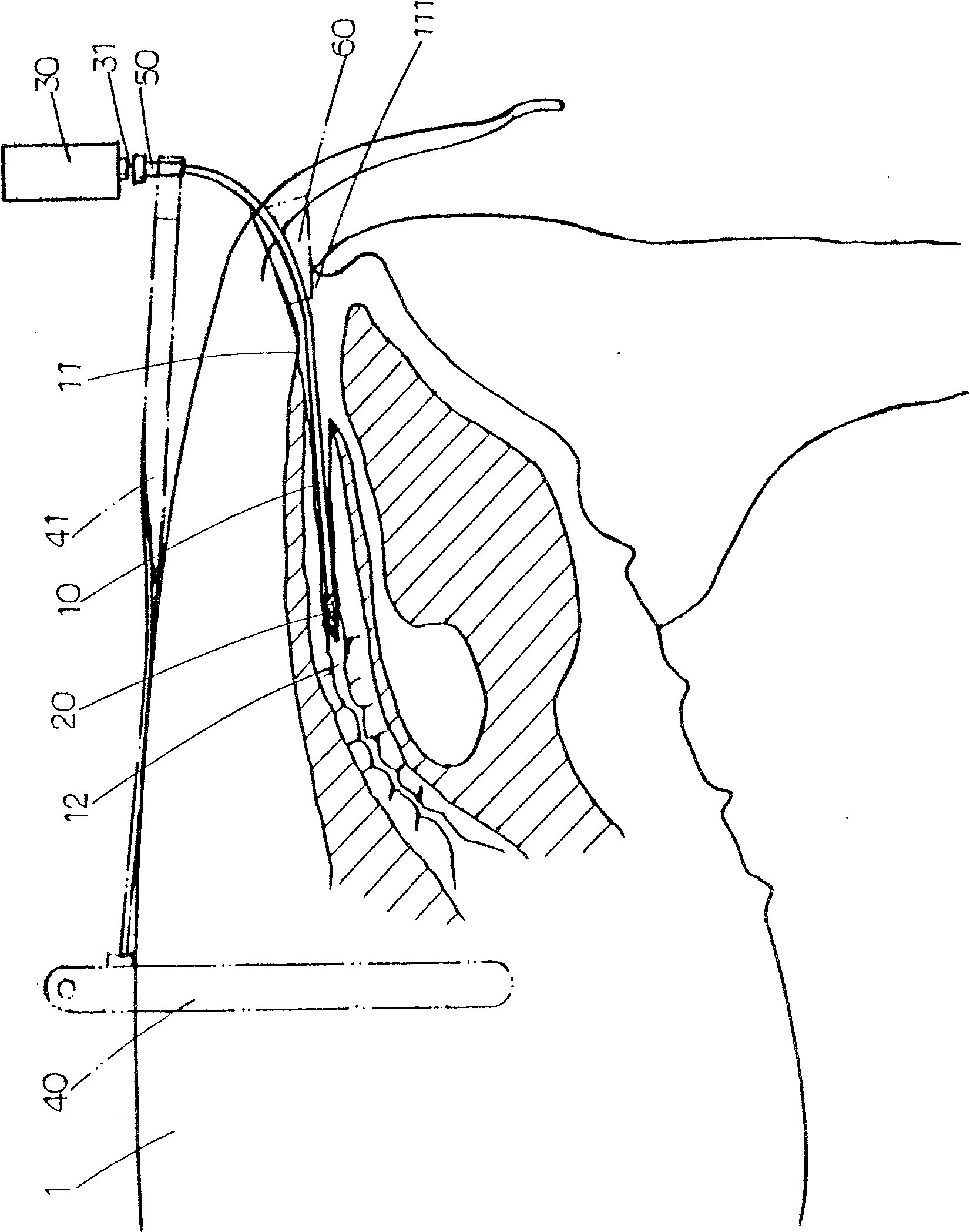 Artificial trace insemination device for animal