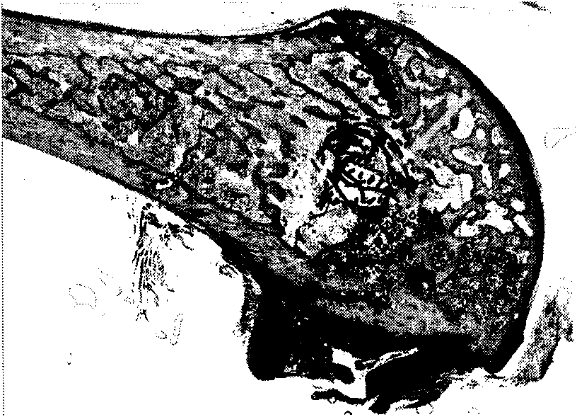 Material for repairing defect of human body bone and preparation method thereof