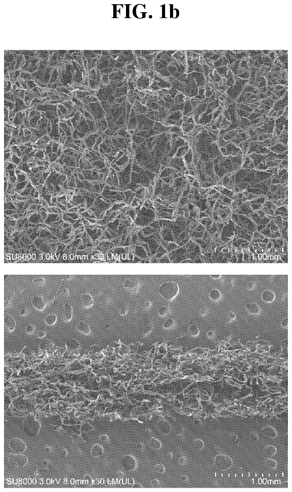 Medical fibrous structure comprising calcium carboxymethyl cellulose and chitosan compound and process for preparing the same
