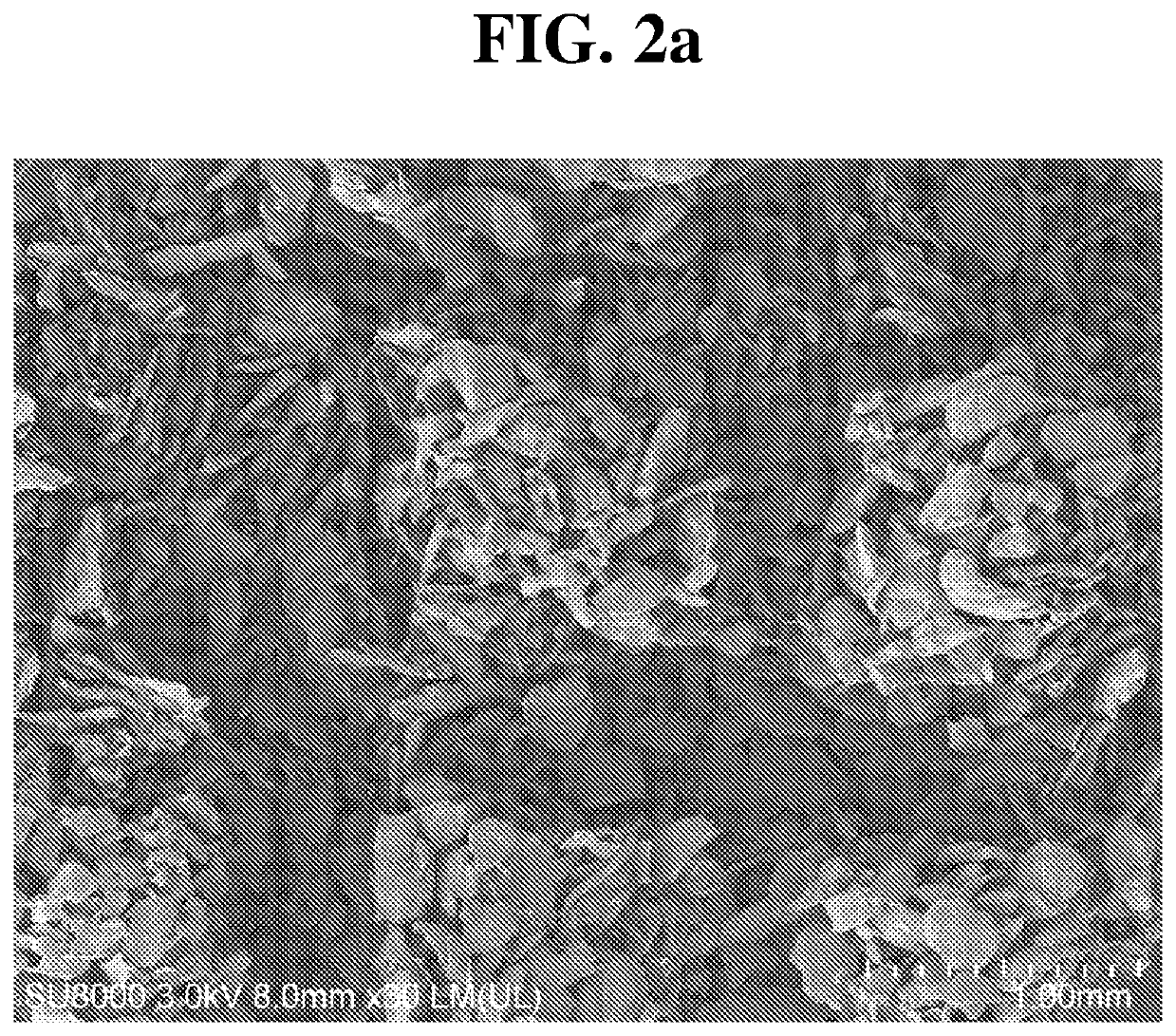 Medical fibrous structure comprising calcium carboxymethyl cellulose and chitosan compound and process for preparing the same