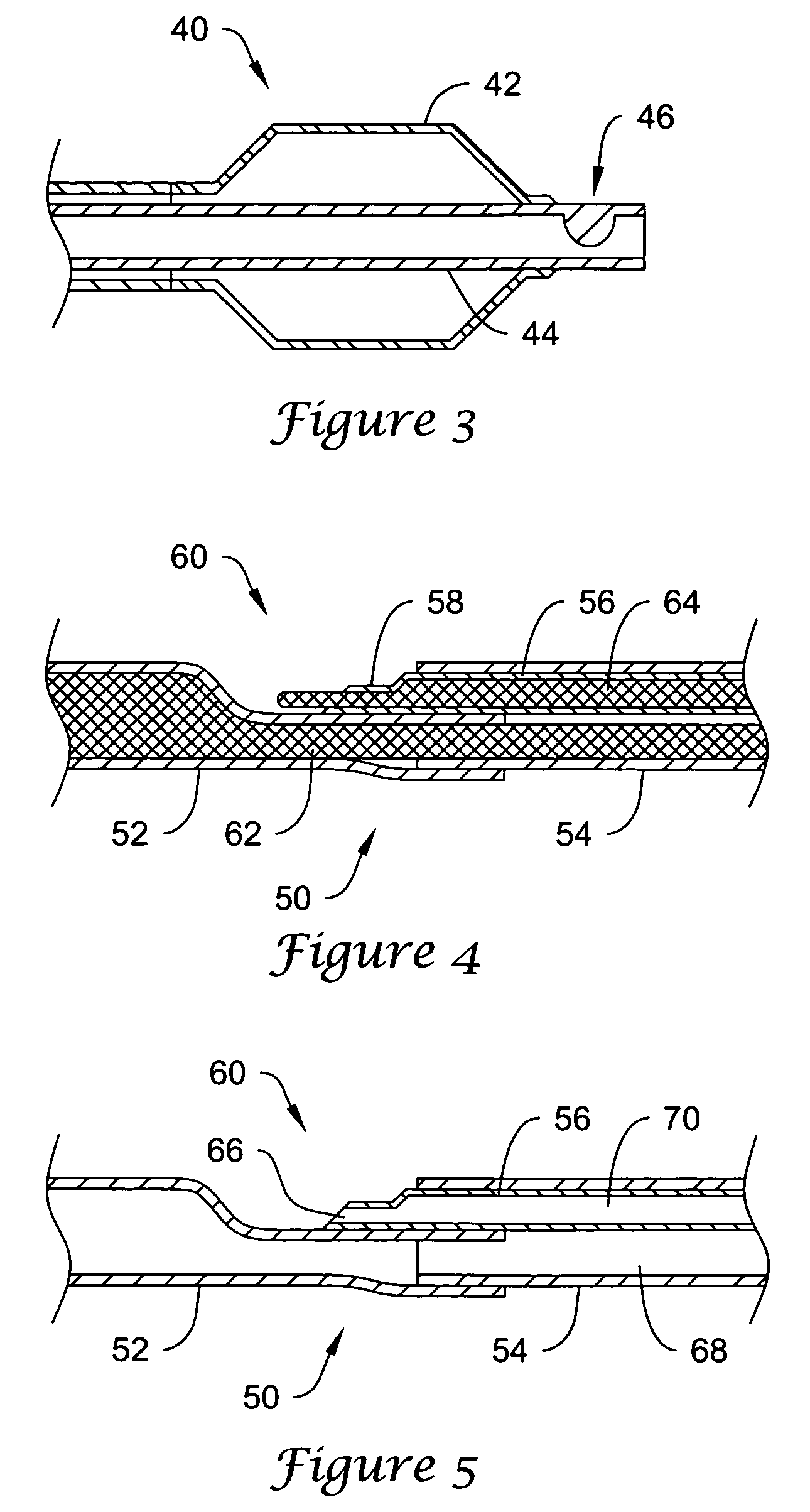 Rapid exchange catheters having a sealed guidewire lumen and methods of making the same