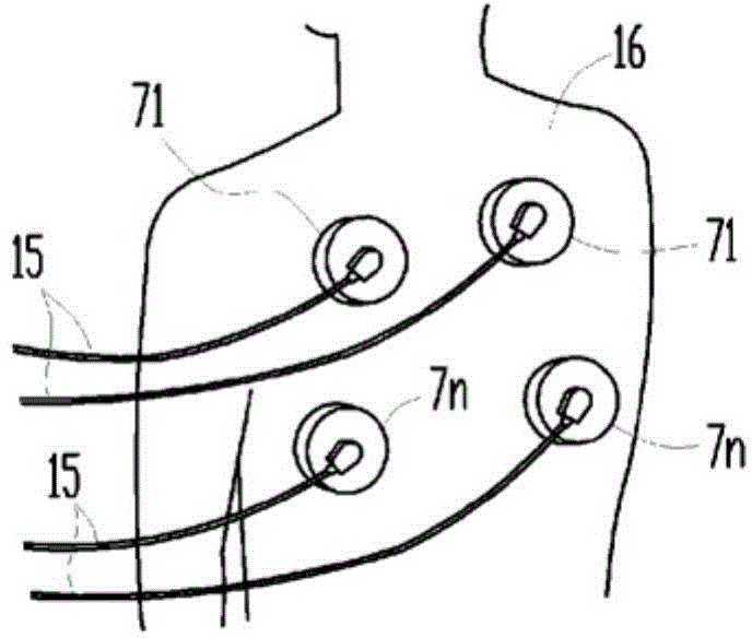 Electric stimulation device