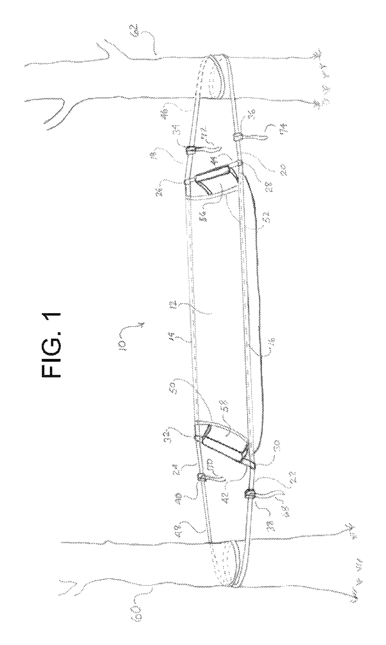 Independent hammock suspension system