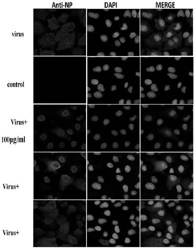 Application of pterodontic acid in the preparation of medicine for preventing or treating influenza