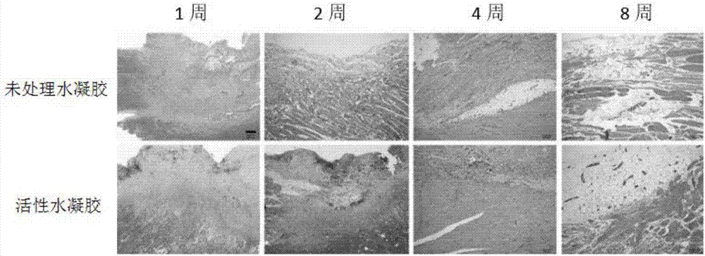 Active hydrogel, preparation method and application thereof in operative wound healing