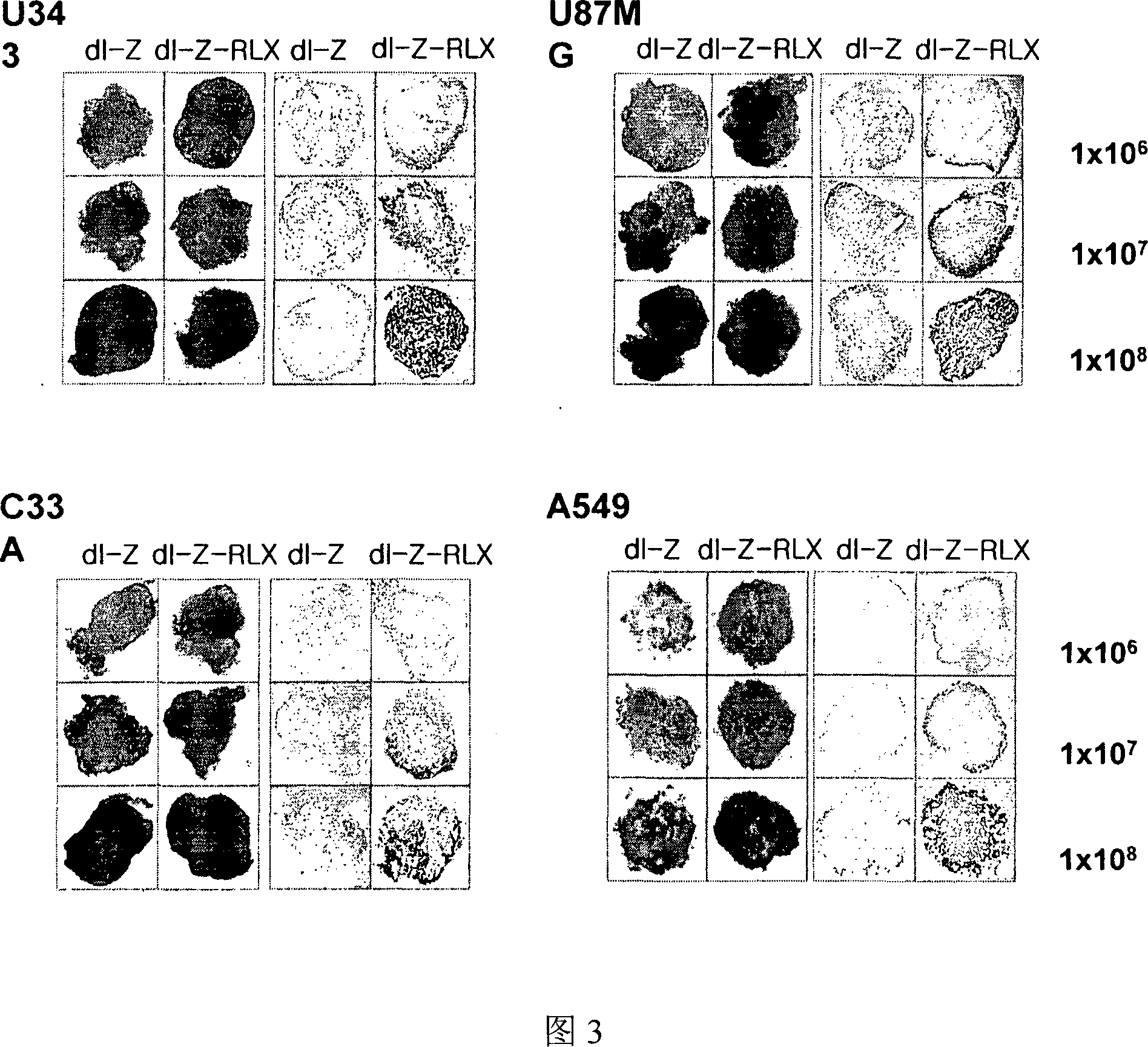 Gene delivery system containing relaxin gene and pharmaceutical composition using relaxin