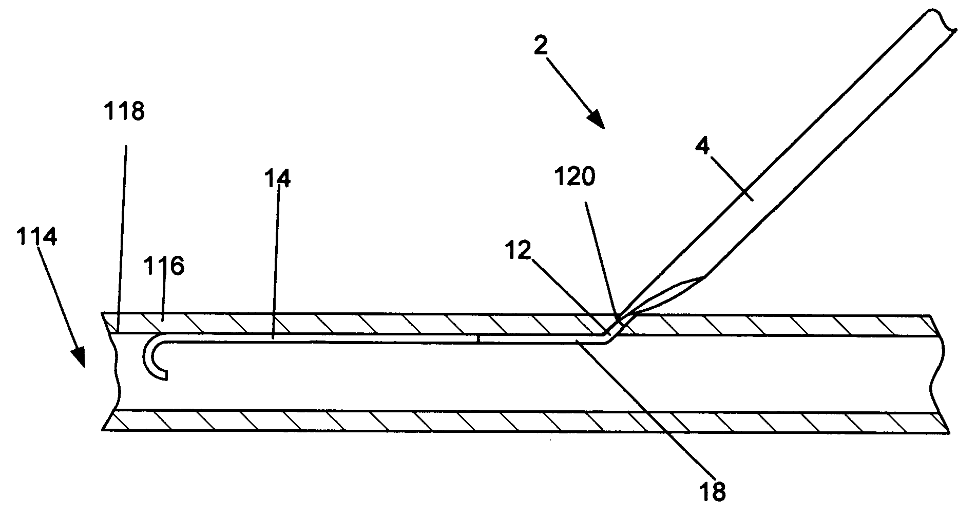 Access and closure device and method