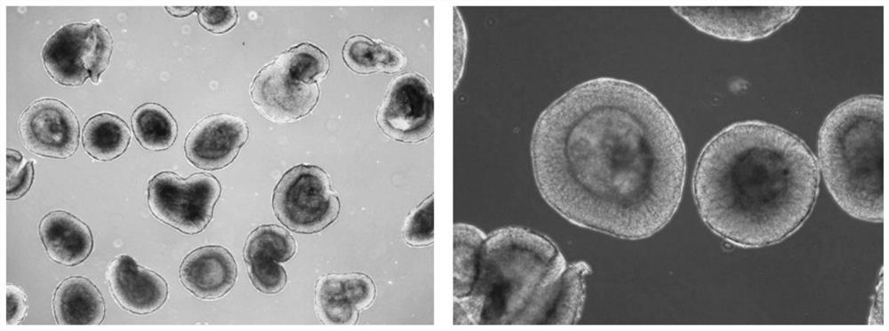 A method for cryopreservation and recovery of three-dimensional retinal tissue