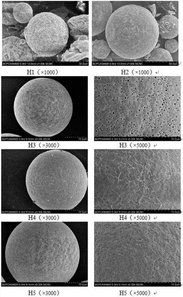 Thymopentin sustained release microsphere and its preparation method and application