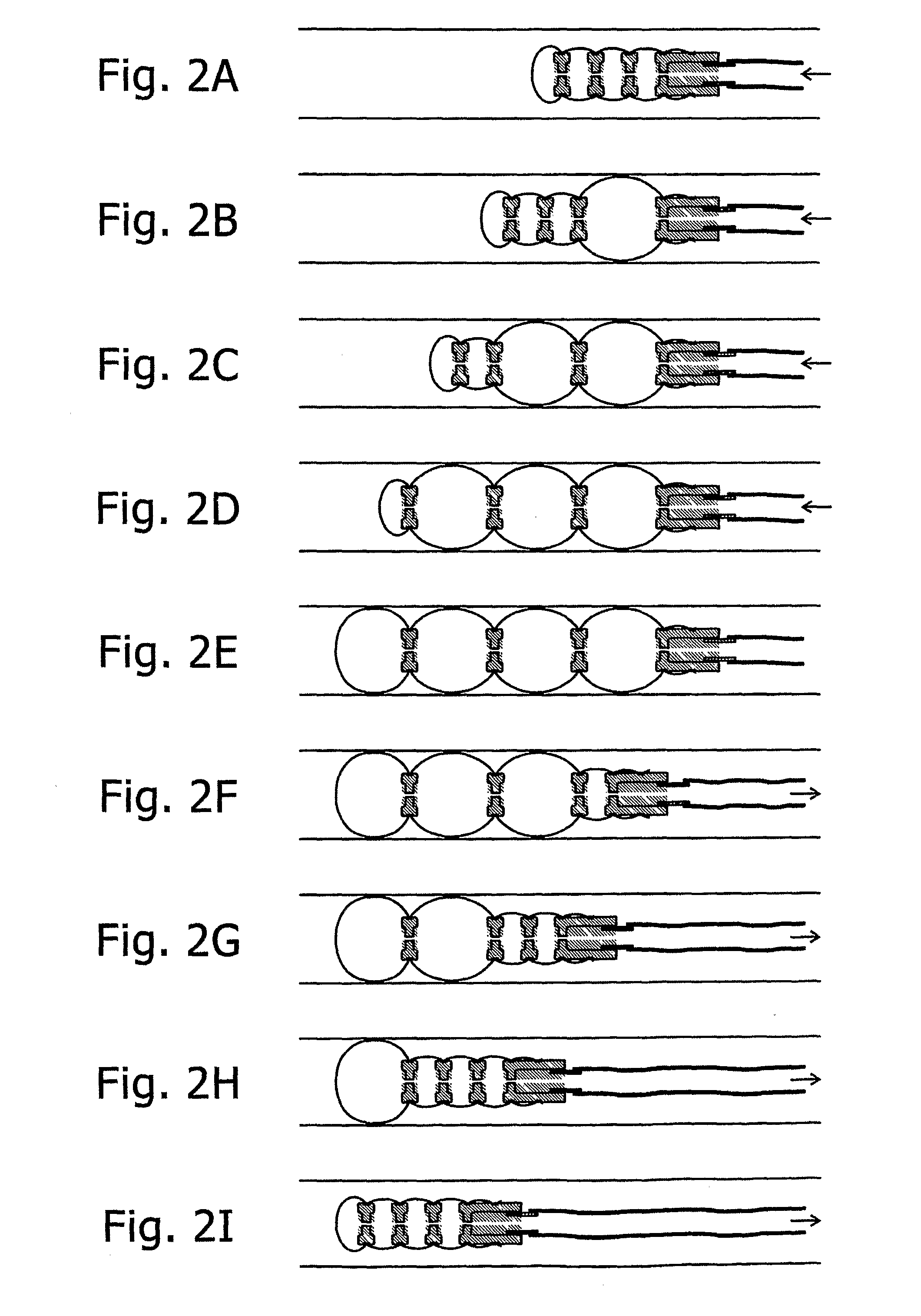 Inflatable chamber device for motion through a passage