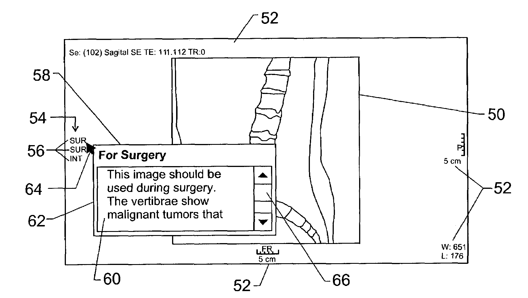 Key image note display and annotation system and method