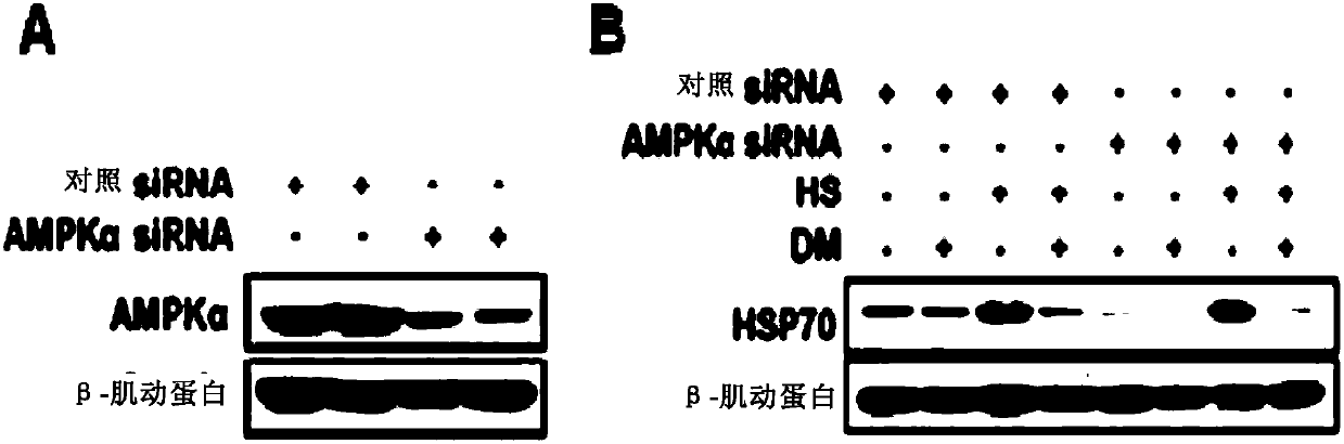 Inhibitor of heat shock factor 1, and preparation method and application of inhibitor