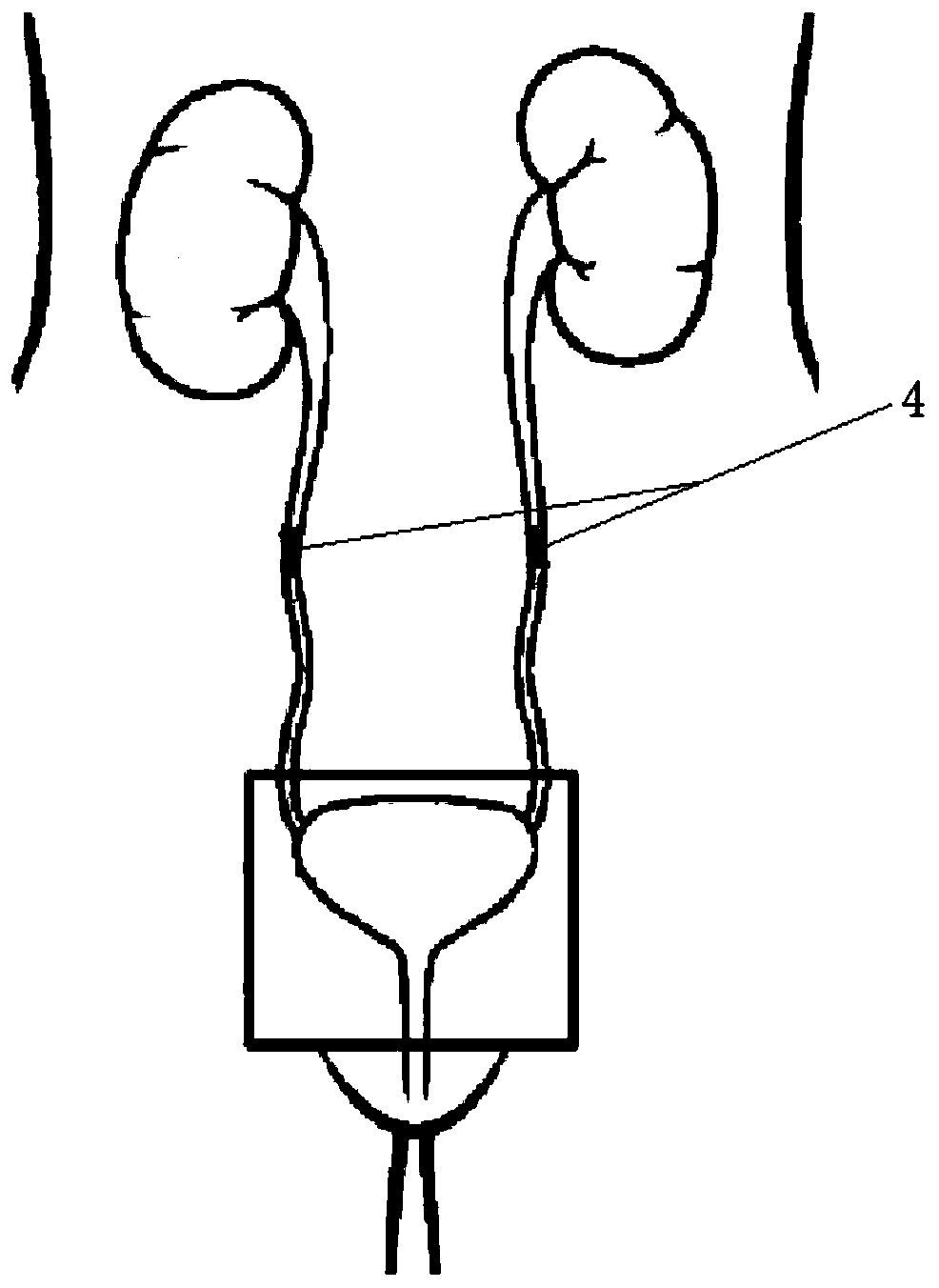 Independent urination assistant device and method