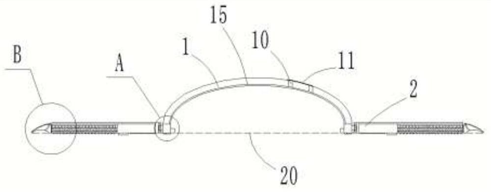 Multifunctional protection eye patch used for ophthalmologic operation