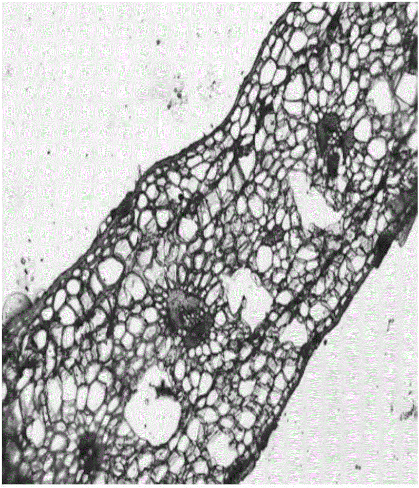 Specimen making method for observing anatomic structure of lamina of tillandsia