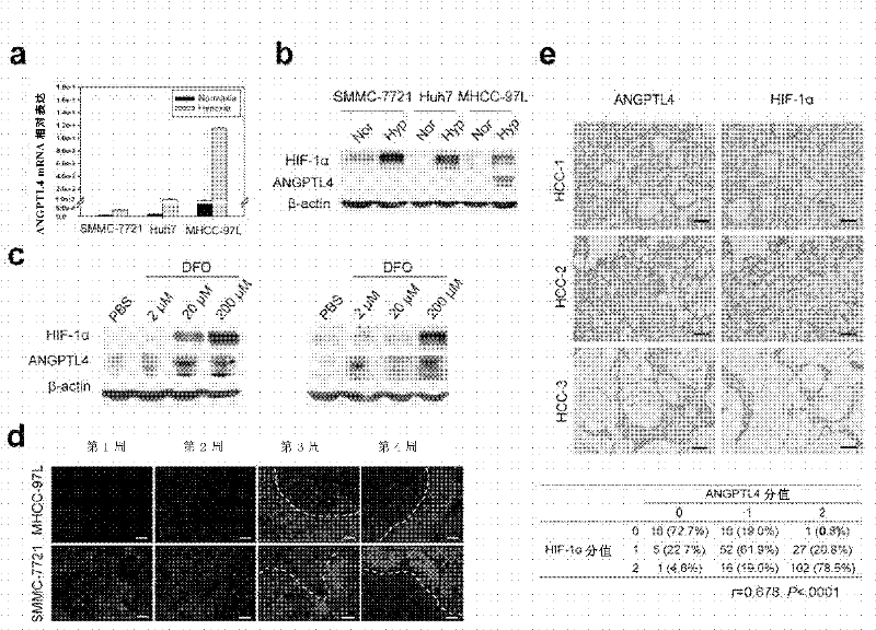 ANGPTL4 as marker of hypoxia detection and application thereof