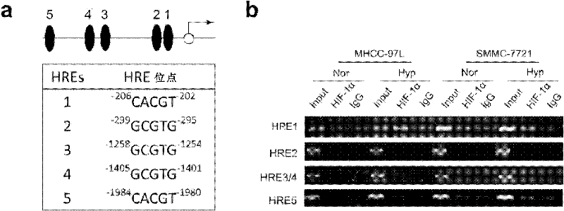 ANGPTL4 as marker of hypoxia detection and application thereof