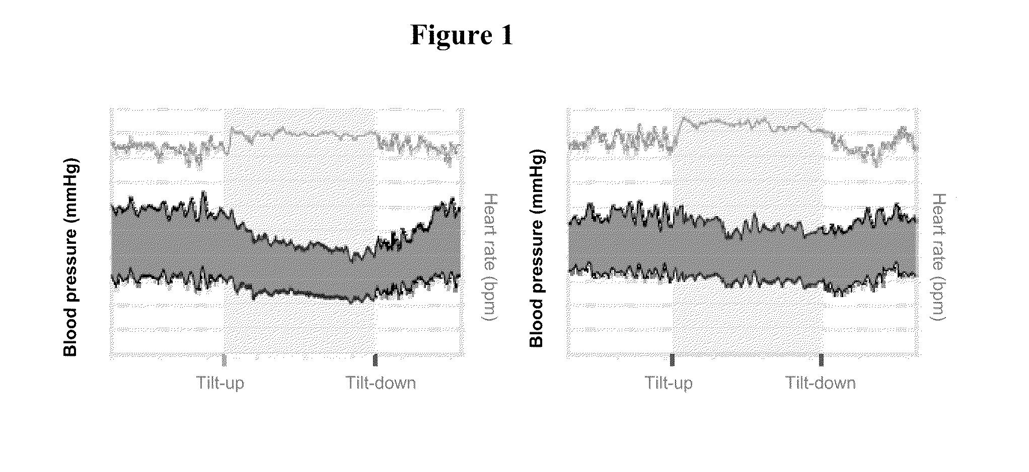 Methods and materials for treating orthostatic hypotension or postural tachycardia syndrome