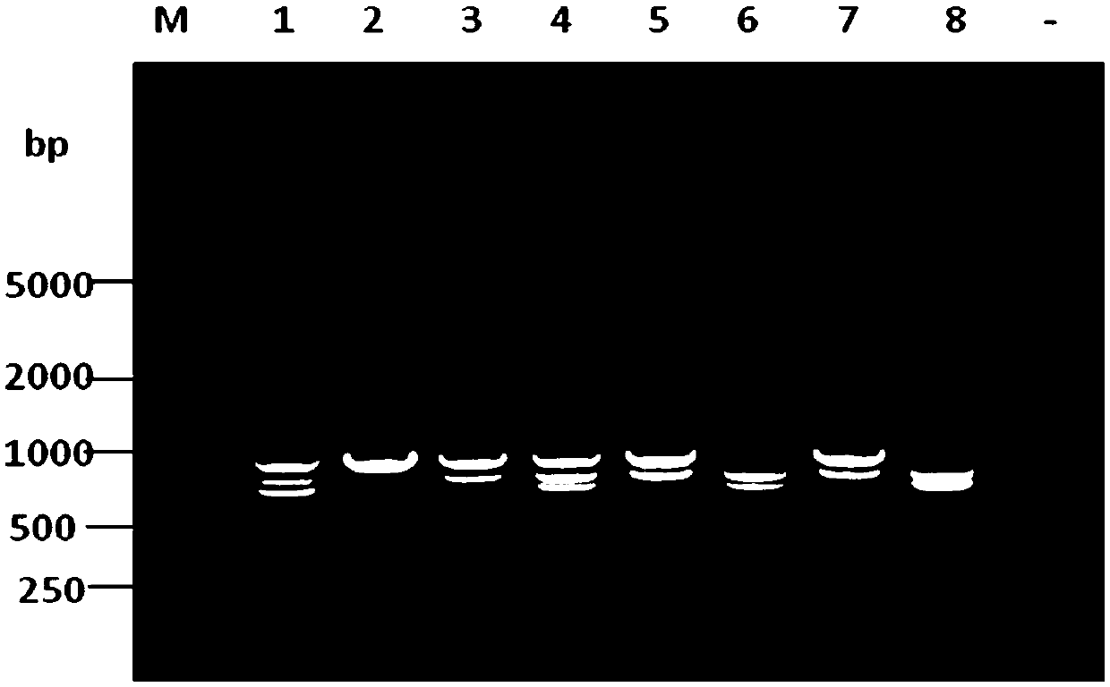 Compound PCR typing kit for distinguishing serotypes of eight pig actinobacillus pleuropneumoniae and application thereof