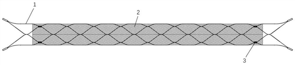 Degradable double-layer stent