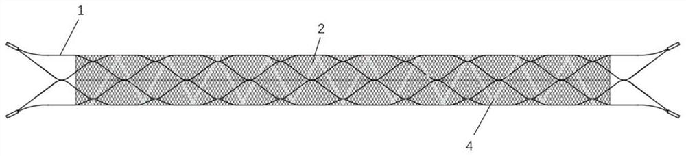Degradable double-layer stent