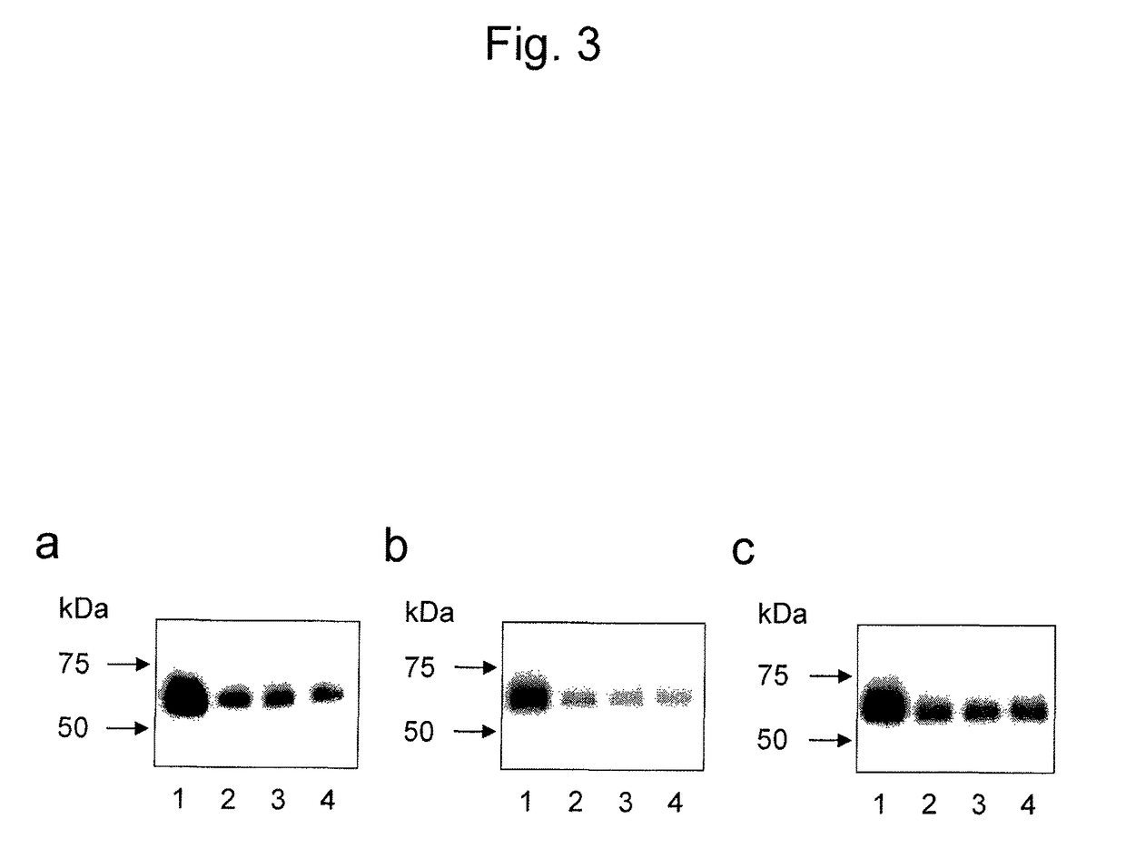 Antibody for detecting epithelial ovarian cancer marker and method for diagnosing epithelial ovarian cancer