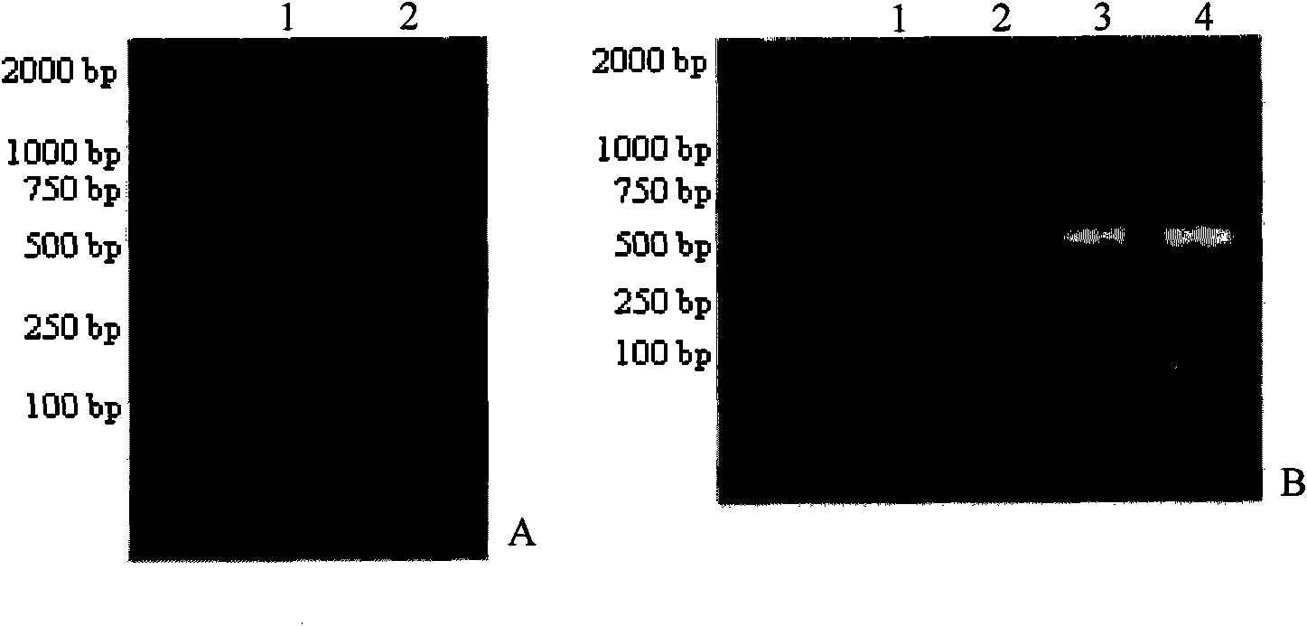 Detection method of infectious spleen and kidney necrosis virus Nest-PCR and kit thereof